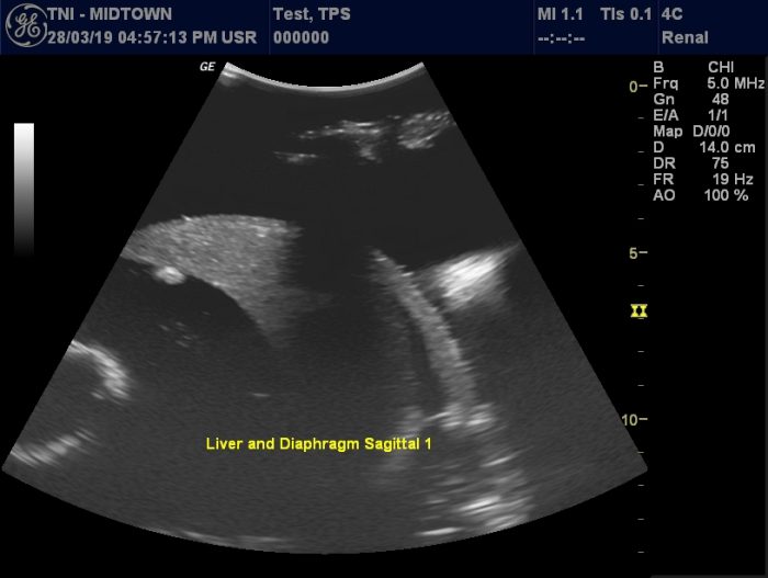 Adult Full Body for X-Ray CT, US - Image 4