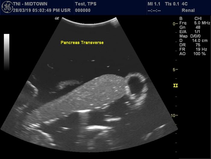 Adult Full Body (with Muscles) for X-Ray CT, US - Image 4