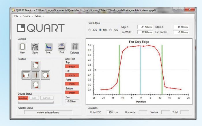Nonius X-Ray Beam Field and Slice Width TesterBrand: Quart - Image 3