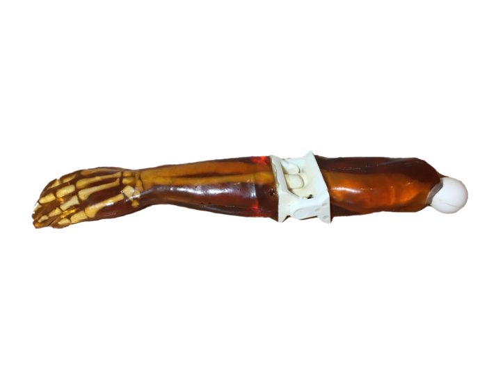 Adult Arm (X-Ray)