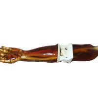 Adult Arm (X-Ray) - Image 2
