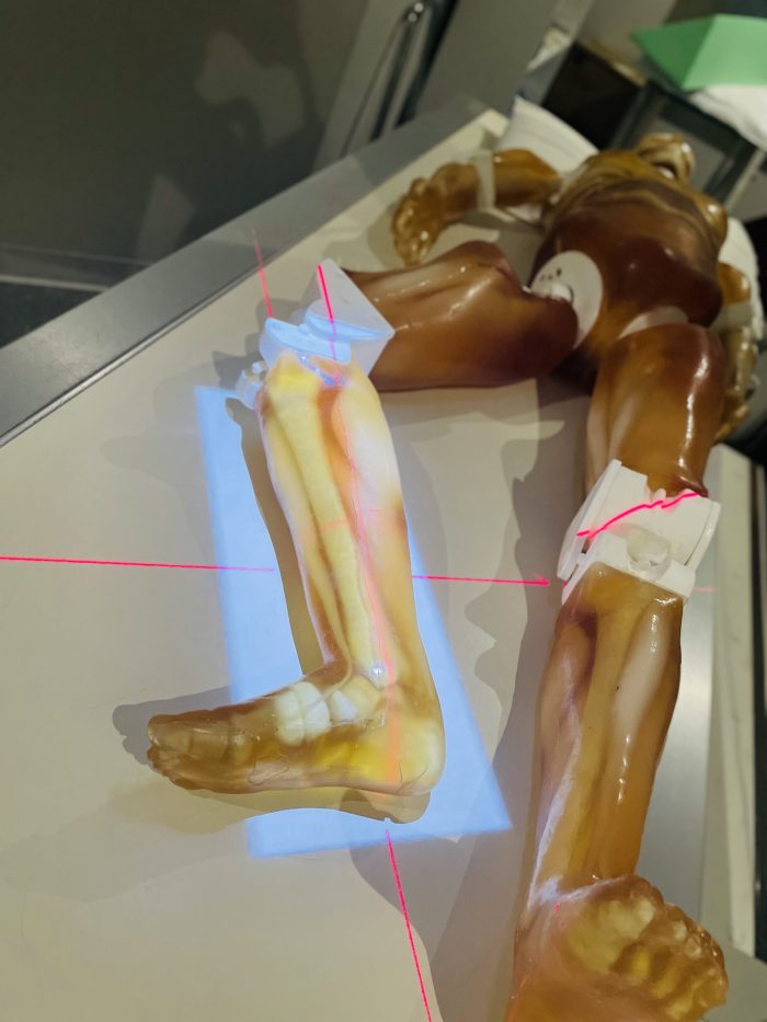Adult Full Body for X-Ray CT, US - Image 2