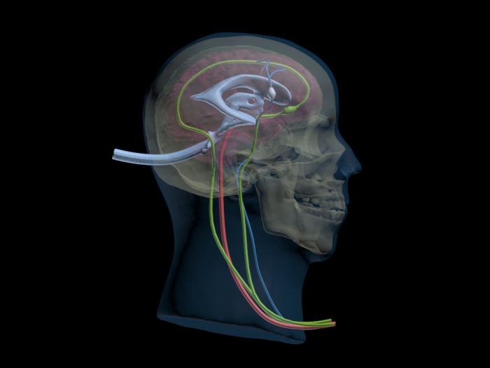 Adult Head (Dynamic, Advanced) for X-Ray CT, US, MRI - Image 3