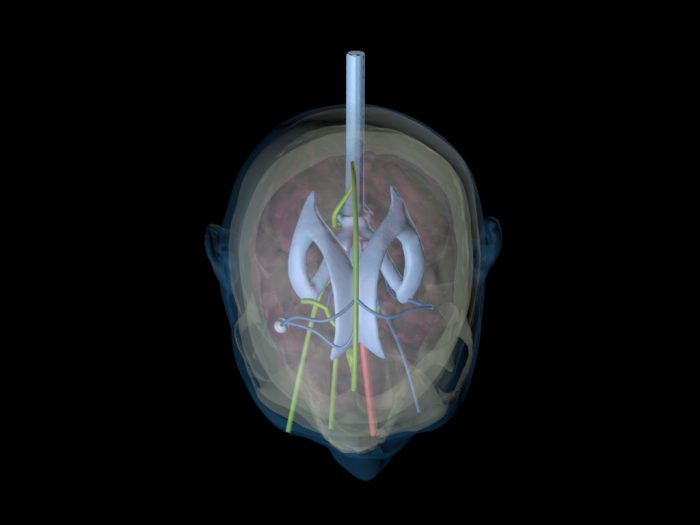Adult Head (Dynamic, Advanced) for X-Ray CT, US, MRI - Image 4