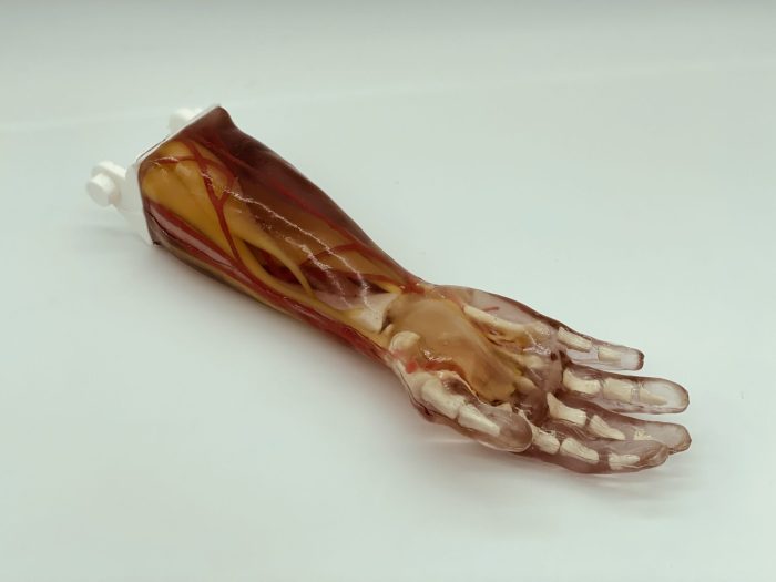 Adult Arm (Advanced) for X-Ray CT, US - Image 3