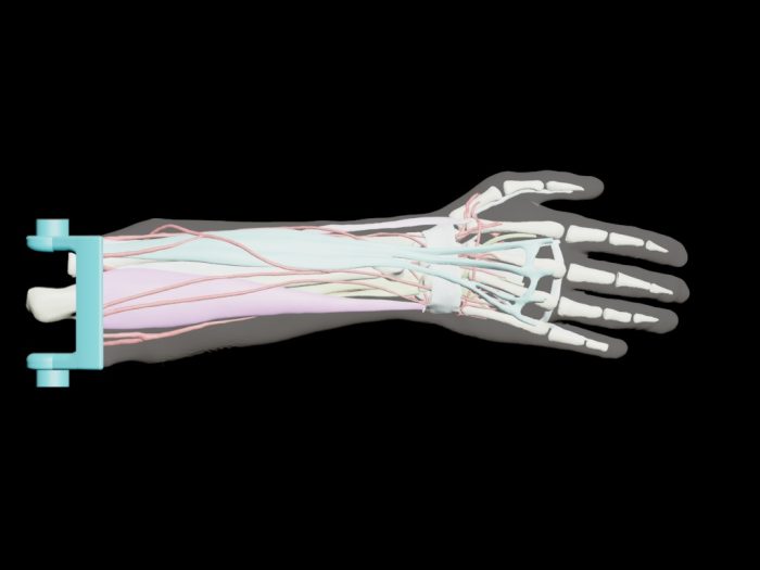 Adult Arm (Advanced) for X-Ray CT, US - Image 4