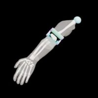 Adult Arm (X-Ray) - Image 4