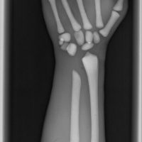 Adult Arm (X-Ray) - Image 3