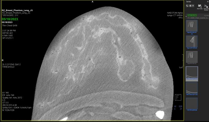Breast Phantom for Medical Imaging - Image 4