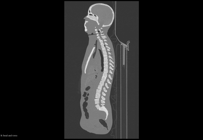 Adult Full Body (with Muscles) for X-Ray CT, US - Image 3