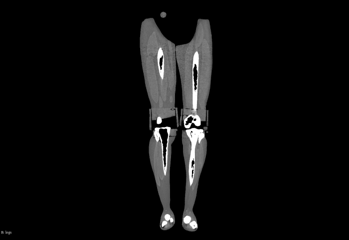 Adult Full Body (with Muscles) for X-Ray CT, US - Image 2
