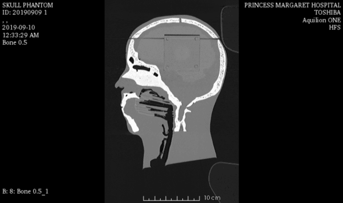 Head QC1 for X-Ray CT, MRI - Image 3