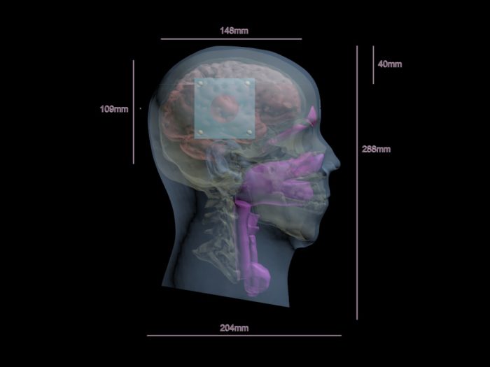 Head QC1 for X-Ray CT, MRI - Image 2