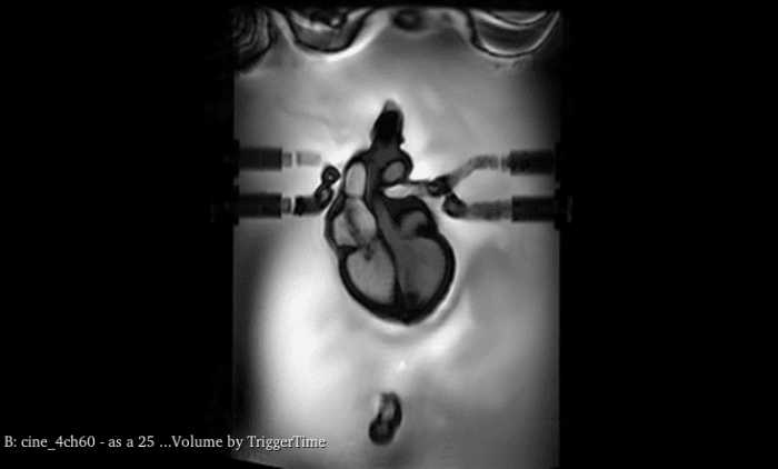 Adult Torso (Dynamic) for X-Ray CT, MRI - Image 4