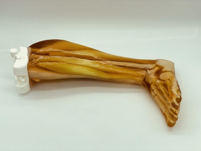 Adult Leg (Muscles) for X-Ray CT, US - Image 2