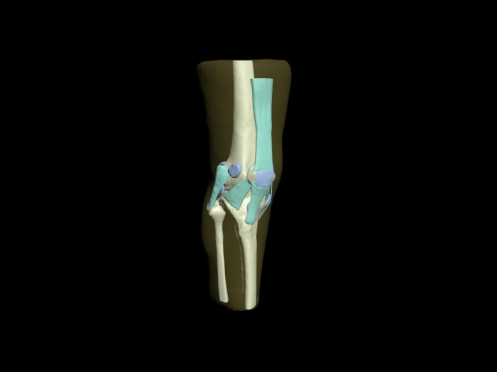 Adult Knee for X-Ray CT, MRI - Image 4