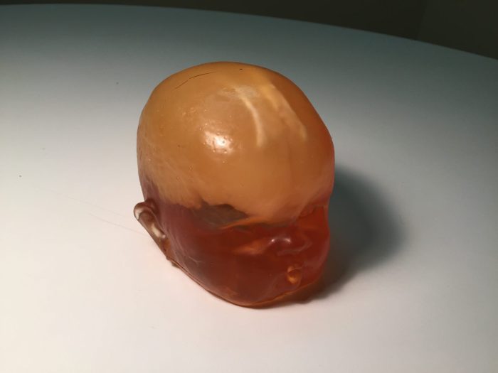 Newborn Head (Complex) for X-Ray CT, US - Image 2