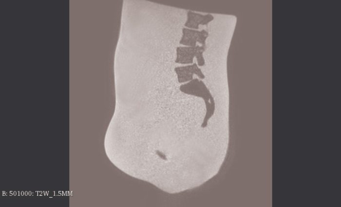 Adult Pelvis with Prostate for X-Ray CT, MRI - Image 4