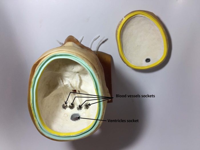 Adult Head (Openable) for X-Ray CT, US, MRI - Image 4