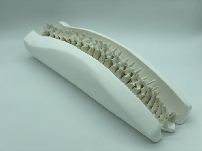 Adult Spine for X-Ray CT