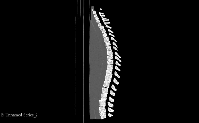 Adult Spine for X-Ray CT - Image 3