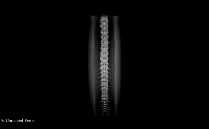 Adult Spine for X-Ray CT - Image 4