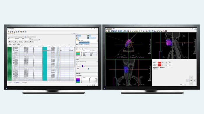 ImageView Radiation Therapy Viewer