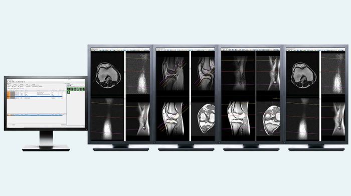 ImageView Advanced Radiology Viewer