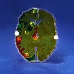 Brain