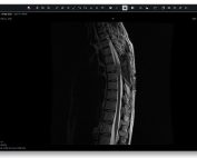 Candelis-Image-Grid-Universal-Viewer