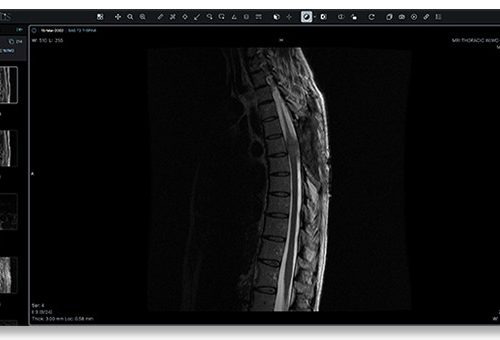 Candelis-Image-Grid-Universal-Viewer