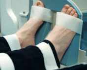 Foot-support-for-SPECT-CT-PET-CT_1