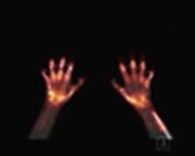 Hand-support-superman-position-01