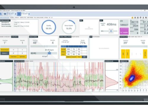 Bittium Cardiac Navigator Dashboard