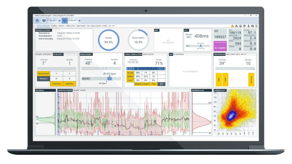 Bittium Cardiac Navigator Dashboard