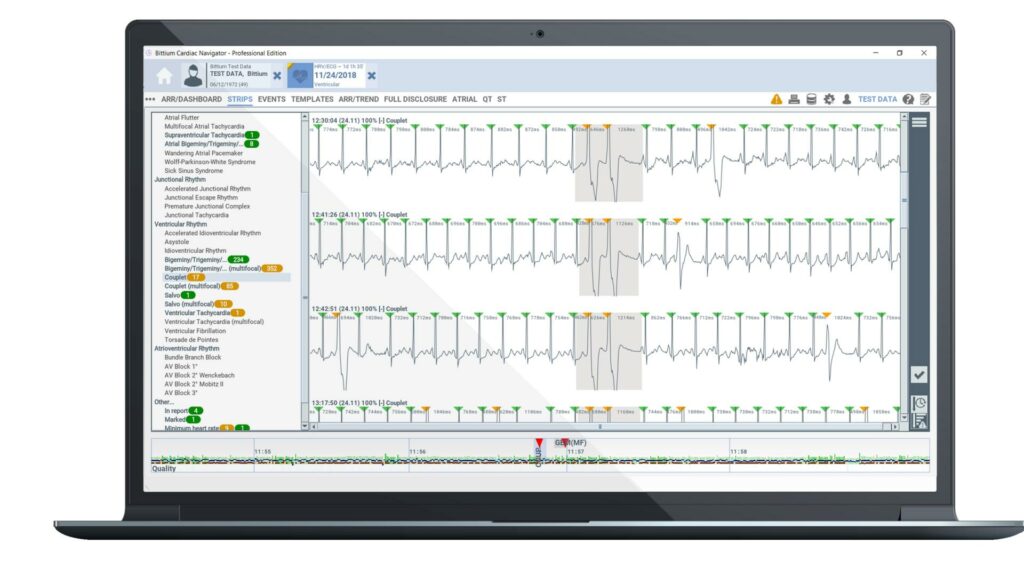 Bittium Cardiac-Navigator Laptop Strip