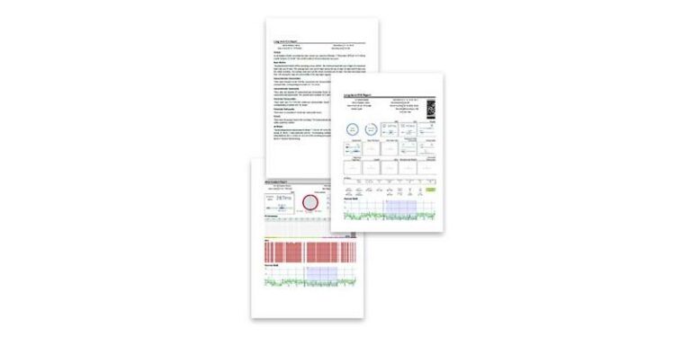 Bittium Cardiac Navigator Reports
