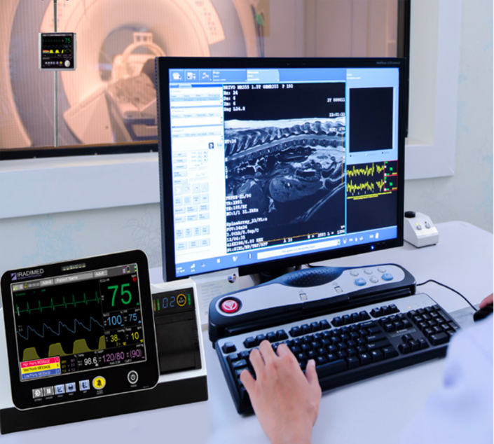 IRadimed MRI Remote Patient Monitor-3